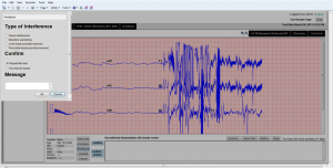 TeleMED offers a Feedback Tool, with a standardized, automated ECG workflow